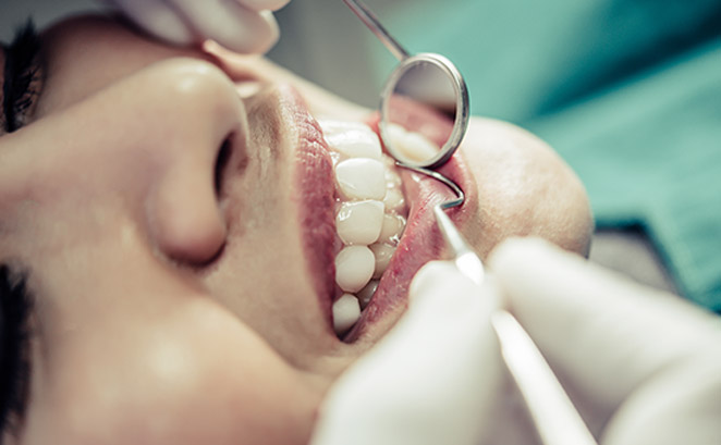 La Importancia de las Revisiones Dentales Regulares: Más que un Control de Rutina