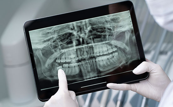 El papel de la tecnología en la odontología moderna